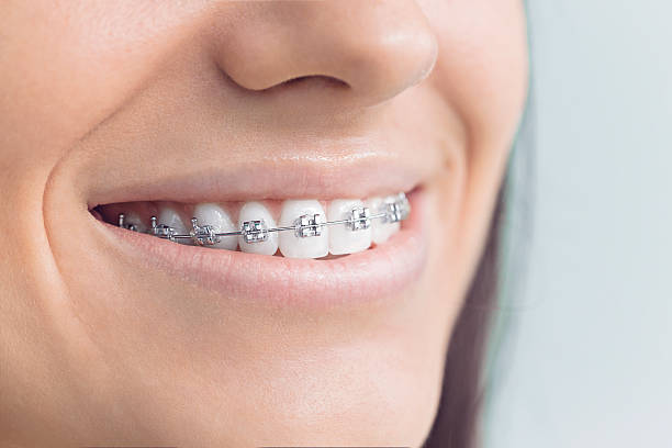 Best Dental Inlays and Onlays  in New London, MN